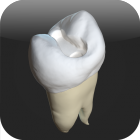 CavSim : Dental Cavity Trial